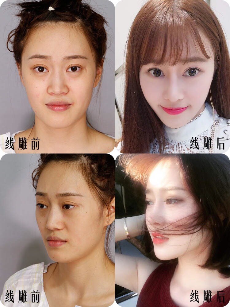 线雕品牌前十排名榜.线雕品牌前十排名榜最新？-第2张图片