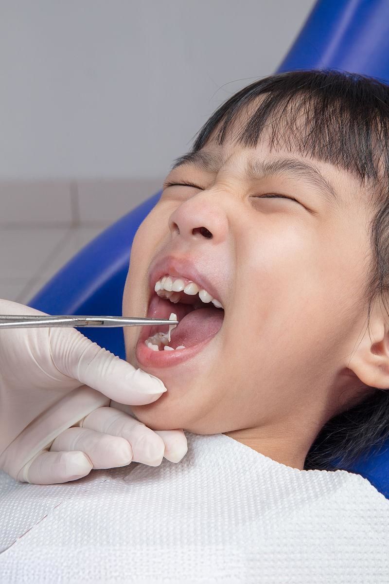 河南拔智齿是什么意思网络用语(河 南 拔 智 齿)-第1张图片